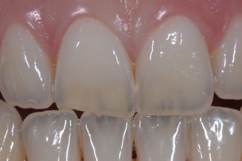 blog-image
