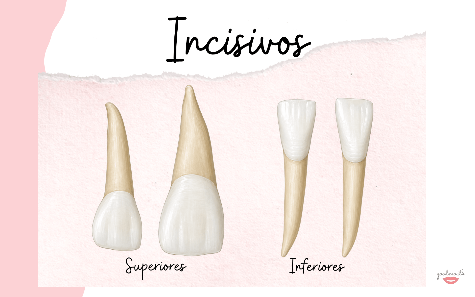 Incisivos