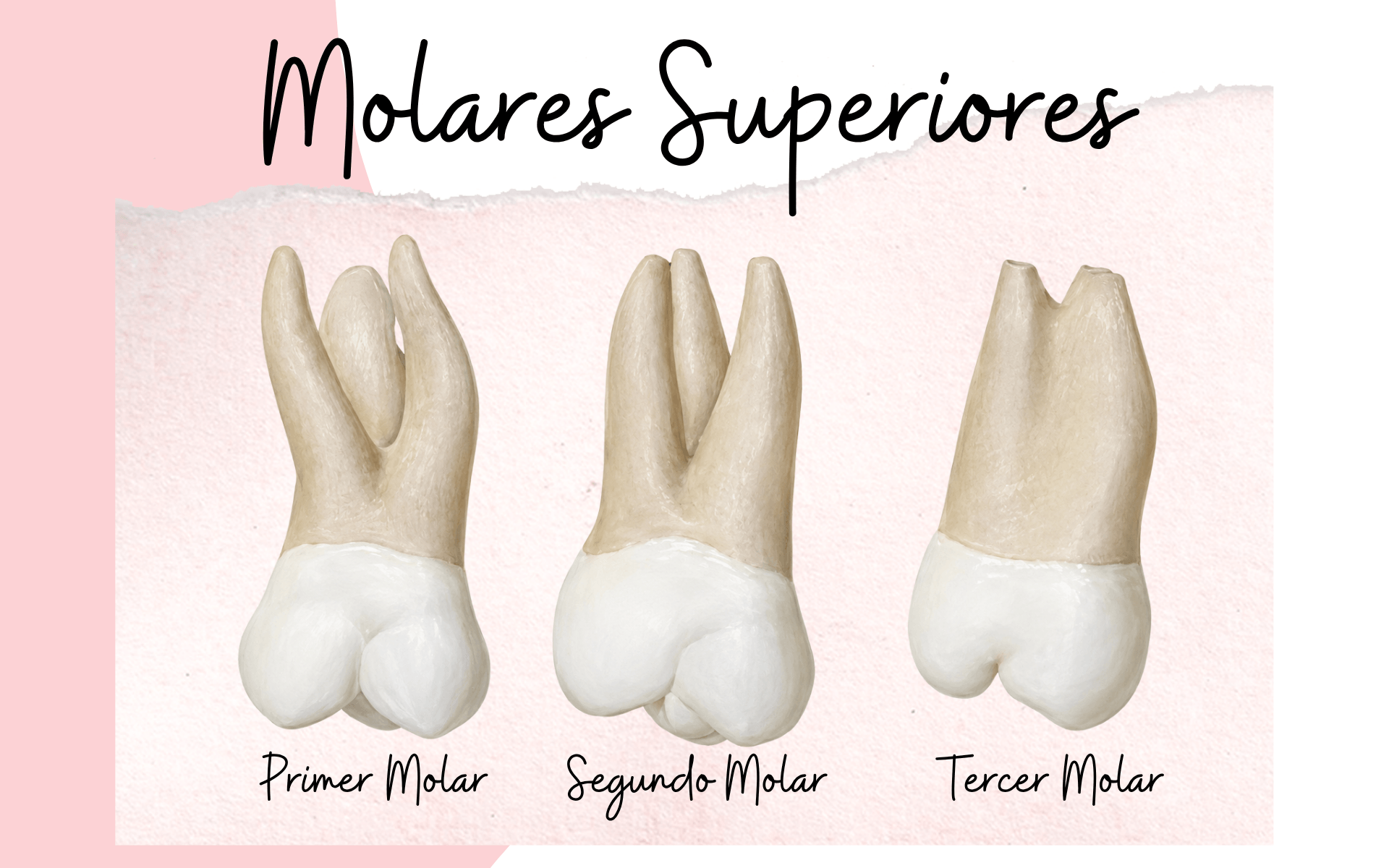 Molares Superiores