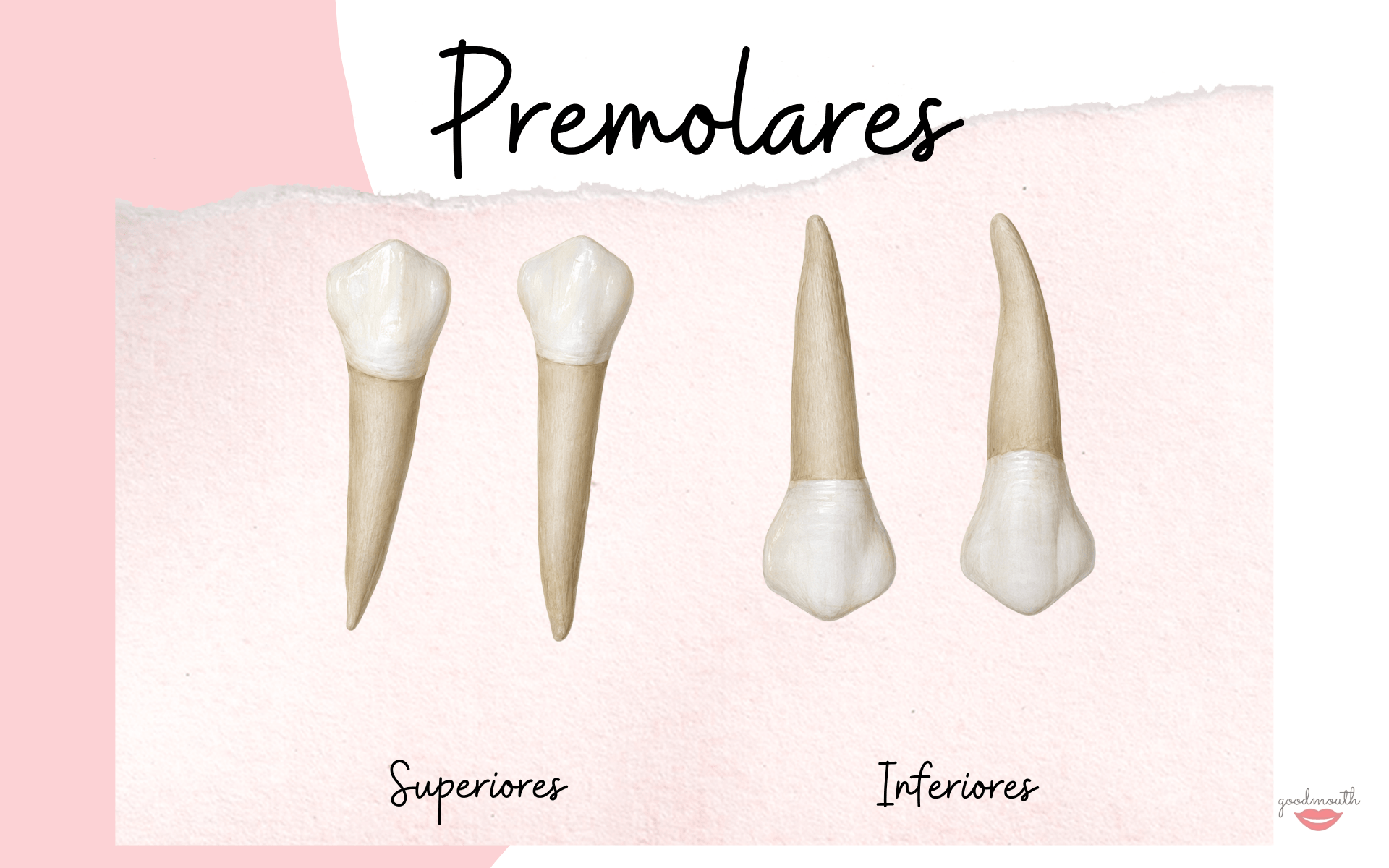 Premolares